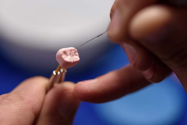 Dental Crown &# ; When Does It Need To Be Repaired?